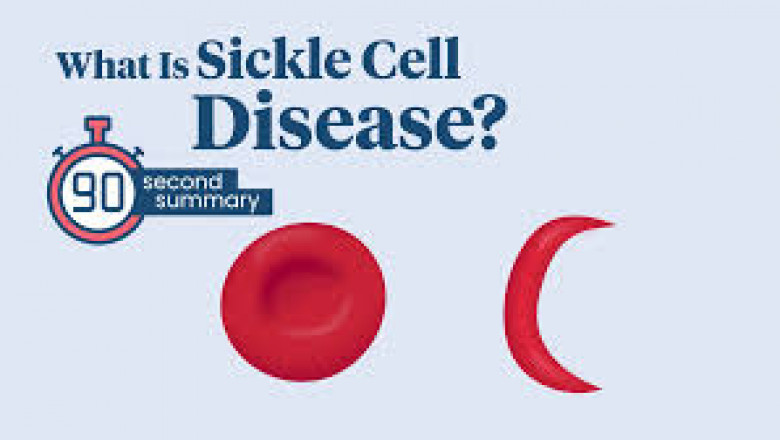 Sickle Cell Disease: Understanding the Genetic Blood Disorder