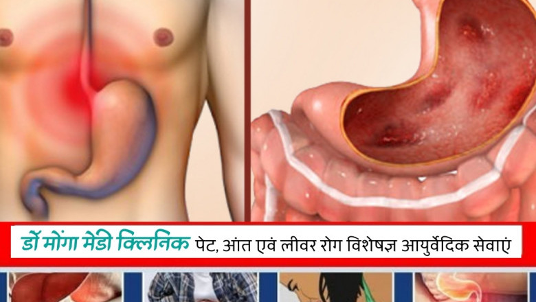 Liver Rog Specialist in Dwarka Delhi Call 8010931122