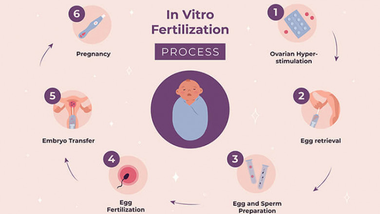 IVF Treatment In Delhi - Dr Rhythm Gupta