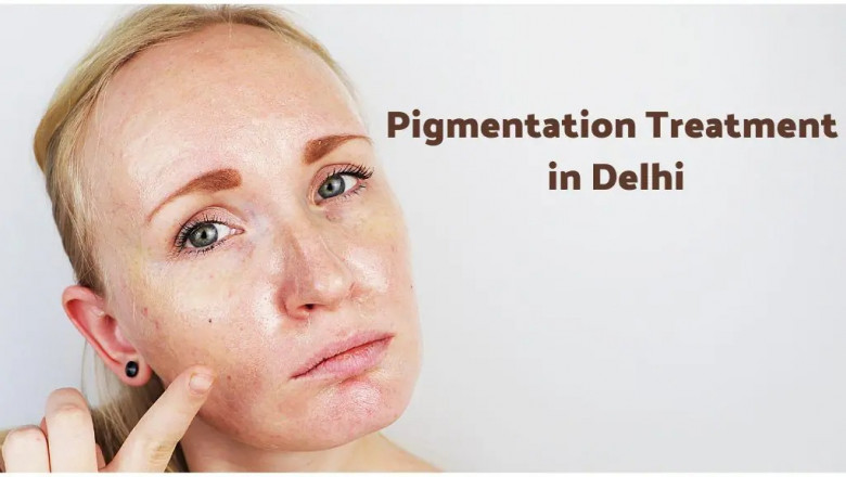 Comprehensive Guide to Pigmentation Treatment in Delhi: Causes, Types &amp; Advanced Solutions