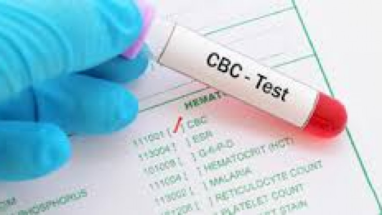 Preparing for Your First Visit to a Pathology Test Lab: What to Expect