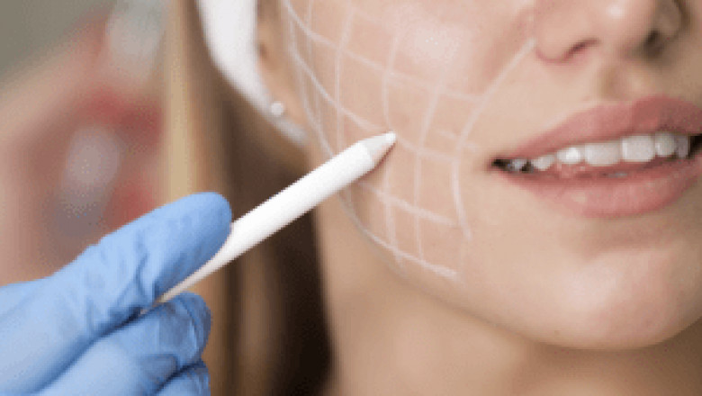 How Long Do Fillers Last? Expectations from Your Filler Treatment in Dubai