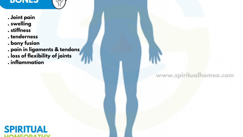 Effective Homeopathy in Hyderabad for Ankylosing Spondylitis – Regain Your Mobility Naturally