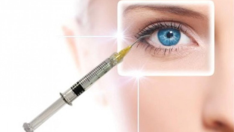 Japan Ophthalmic Viscoelastic Devices Market: Opportunities in Cataract and Glaucoma Surgeries