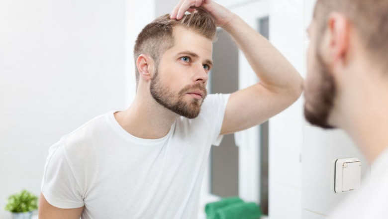 Preparing for Hair Transplantation: A Guide