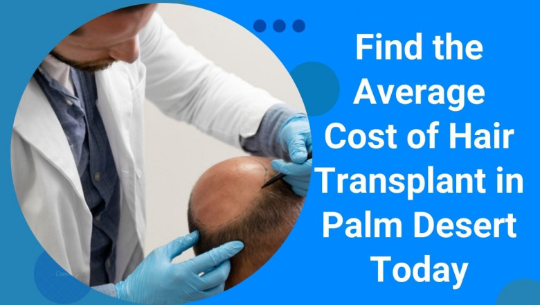 Find the Average Cost of Hair Transplant in Palm Desert Today