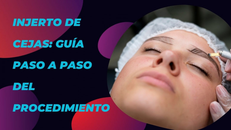 Injerto de Cejas: Guía Paso a Paso del Procedimiento