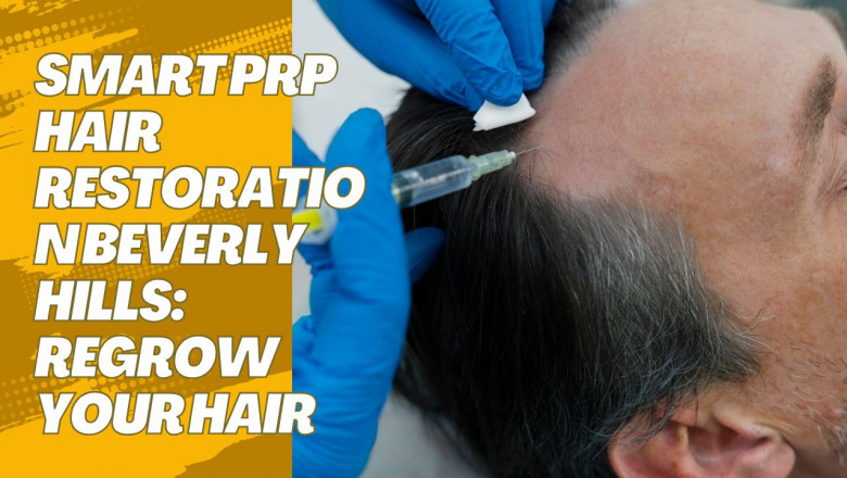 Smart PRP Hair Restoration Beverly Hills: Regrow Your Hair