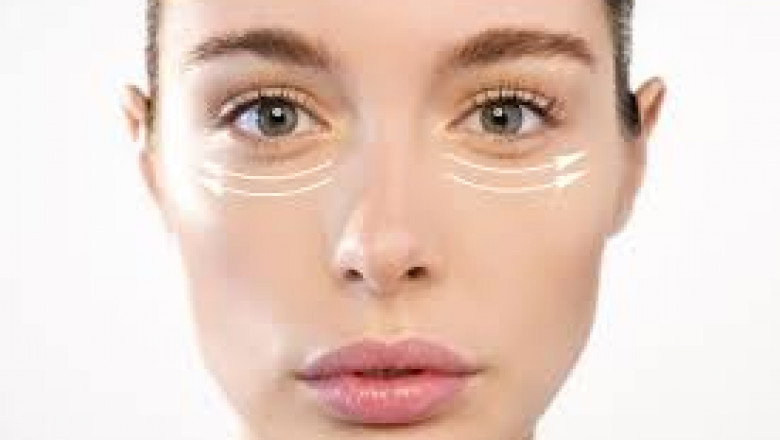 Finding a Qualified and Experienced Oculoplastic Surgeon for Eye Bag Surgery