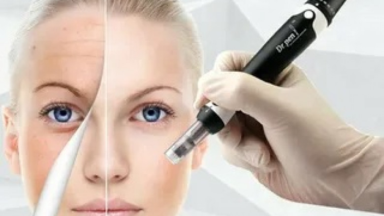 Potential Temporary Side Effects and Risks Associated with Derma Pen Treatments Considering the Local Climate
