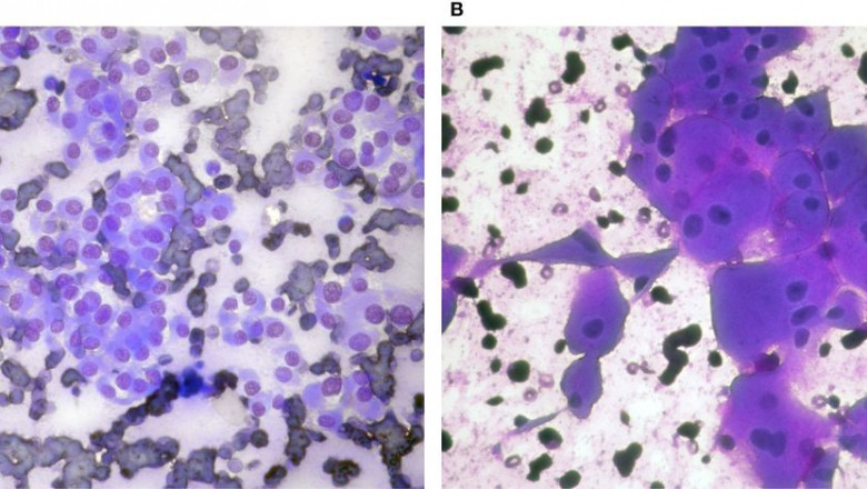 U.S. Histology and Cytology: Trends in Diagnostic Pathology and Laboratory Medicine