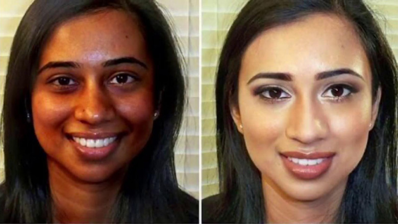 عيادة تجميل بالرياض