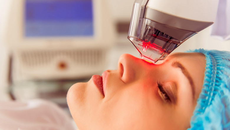 Fractional Laser: Erase Years from Your Face