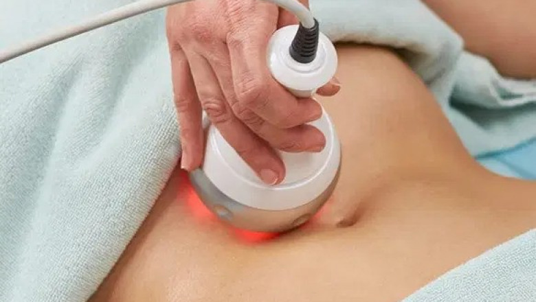 What’s the Best Treatment for Cellulite?