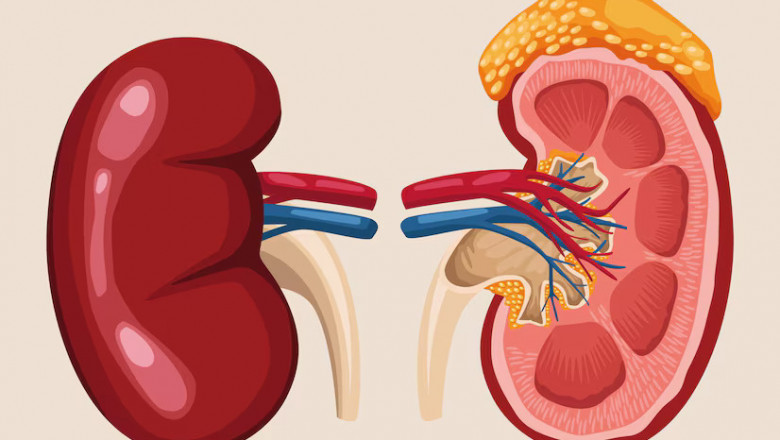Ayurvedic Treatment for Kidney Swelling: Natural Remedies to Reduce Inflammation