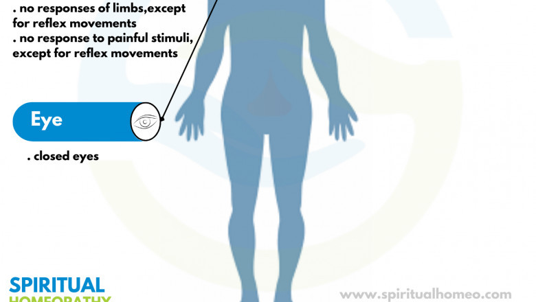 Coma Care Support at a Trusted Homeopathy Clinic in Hyderabad