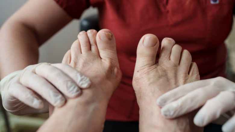 Podiatry Scottsdale AZ: Complete Guide to Services, Costs & Insurance