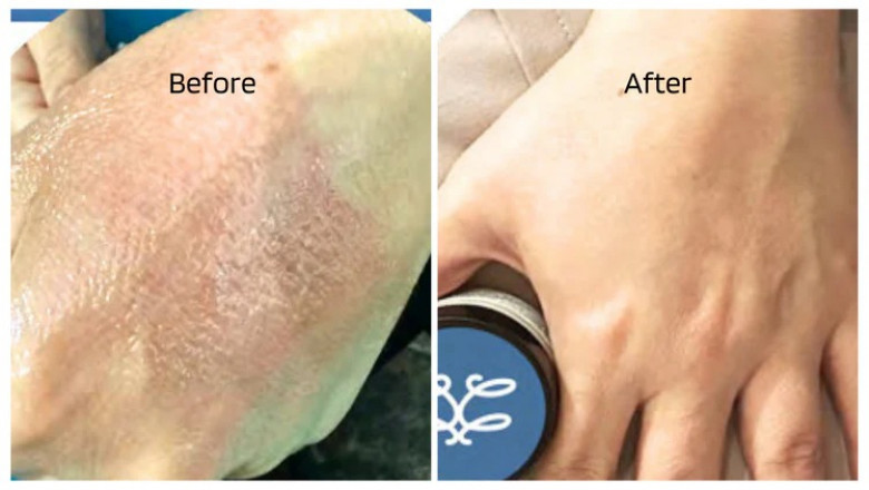 Discover the Power of Natural Body Creams Today