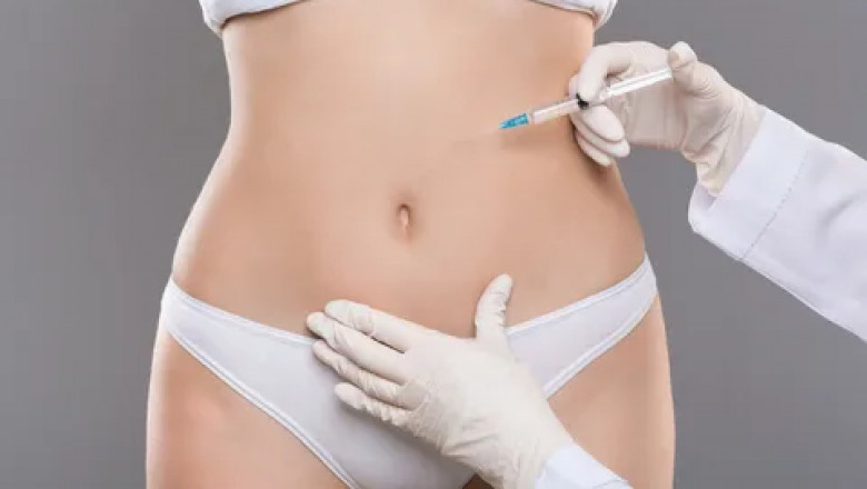 Liposuction in Riyadh: Step-by-Step Procedure Overview