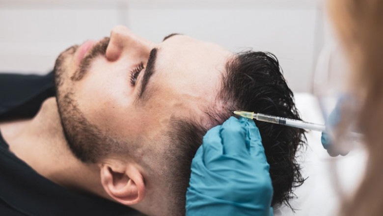 Thicker Hair Without Surgery: PRP Treatment Changing Lives in Delhi
