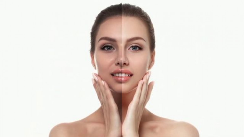 Skin Whitening in Dubai