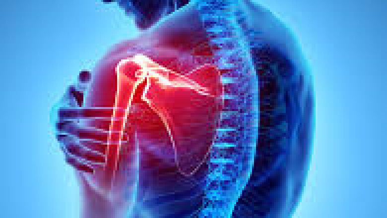 Pain O Soma for Neuropathic Pain: Is It Effective?