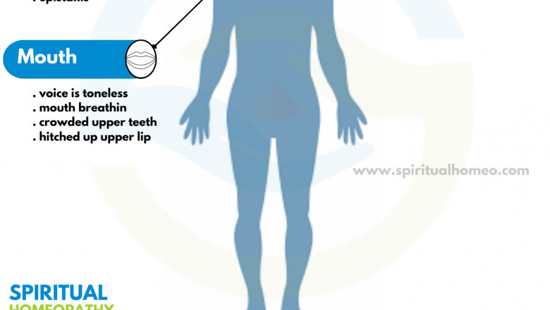 Effective Treatment for Adenoids with Homeopathy in Hyderabad