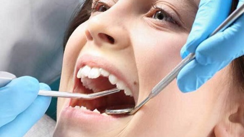 Who Is a Good Candidate for Dental Implants?