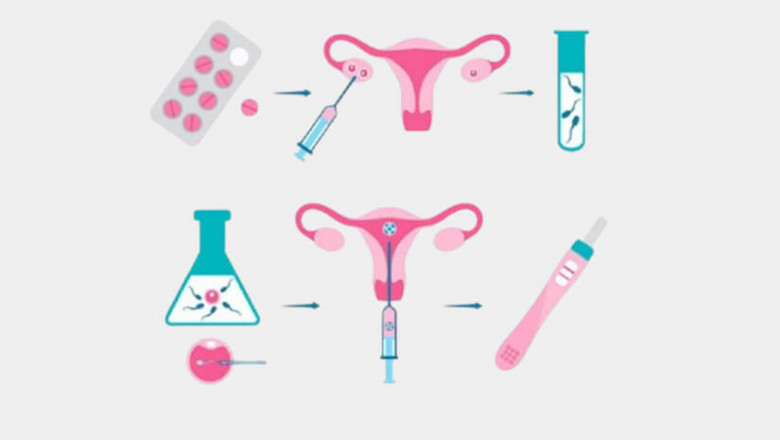 infertility Treatment in women Delhi - Dr Rhythm Gupta
