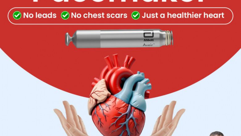 Top 10 Pacemaker Doctors in Delhi – Expert Cardiologists You Can Trust
