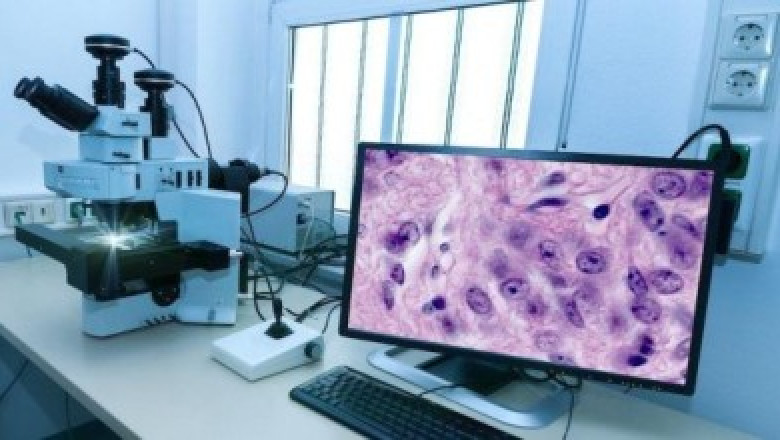 Global Computational Pathology Market: Innovations Transforming Disease Detection