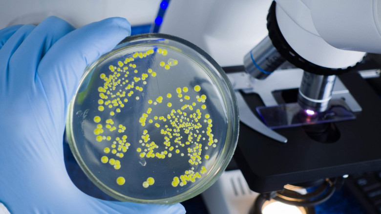 Global E. coli Testing Market: Innovations in Vessel Tracking and Fleet Management
