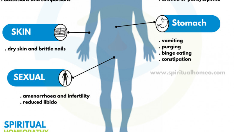 Leading Homeopathy Clinic in Hyderabad for Anorexia Nervosa – Safe & Holistic Care