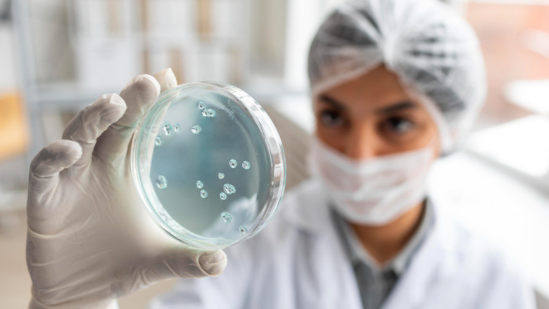 Clinical Microbiology Market Trends 2025: Growth, Innovations, and Forecast