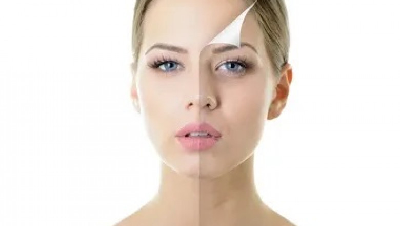 Future Directions in Chemical Peel Research and Development