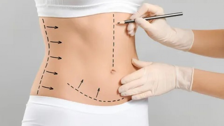 The Future of Precision Body Contouring with Integrated Navigation Systems