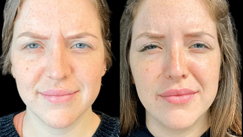 What to Expect on Your First Visit to the Best Aesthetic Clinic in Dubai