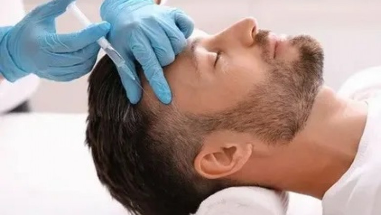 Real Patient Experiences and Before-and-After Photos of Hair Filler Treatments