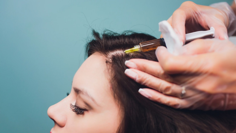 Debunking Myths About Hair Plasma and PRP Therapy