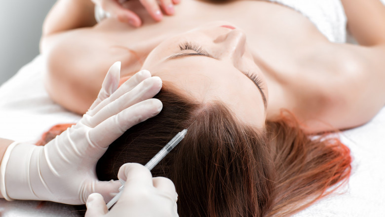 Long‑Term Benefits of Regular Hair Plasma Sessions