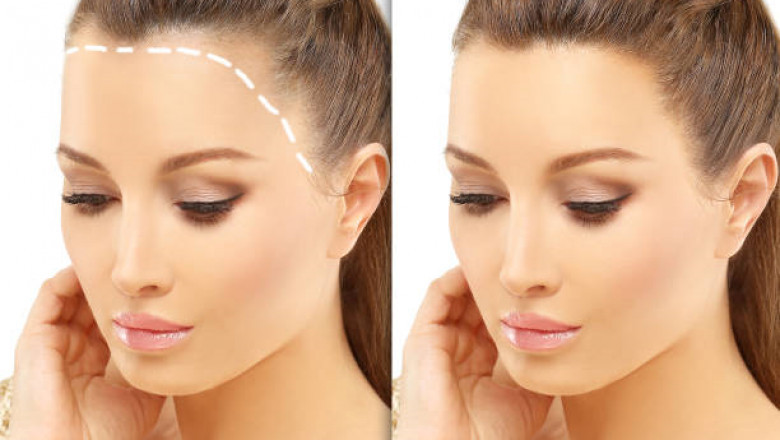 هل زراعة الشعر في الرياض مناسبة لك؟ تعرف على المعايير والشروط