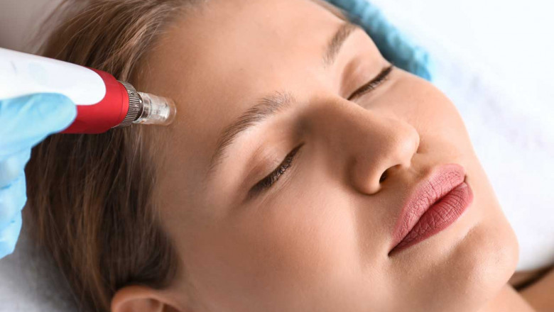 The Ultimate Guide to Dermapen for Beginners