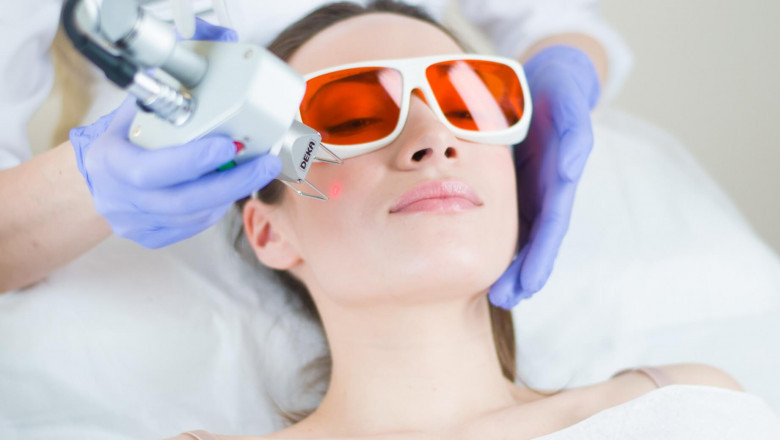 Achieve Flawless Skin with Fractional Laser Sessions