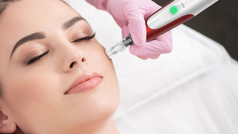 Dermapen: The Microneedling Revolution
