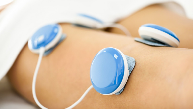 Electrical Stimulators Market Trends 2025: Innovations Driving Growth