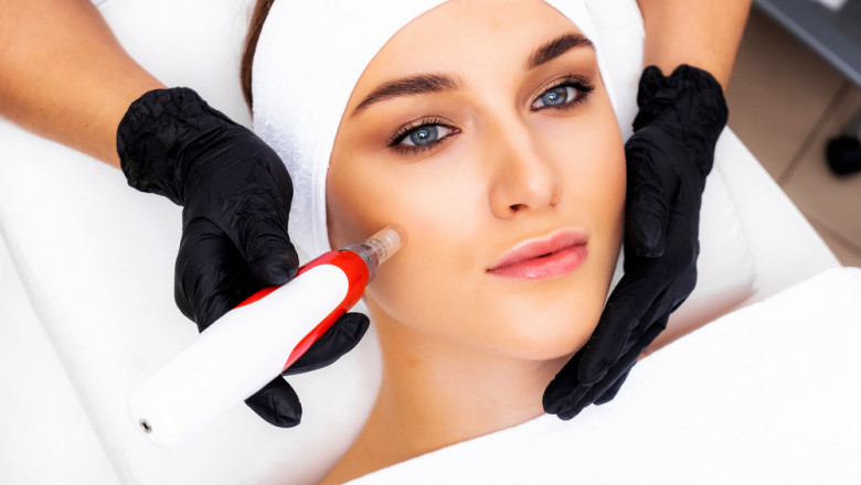 Dermapen: Precision in Skin Treatment for Optimal Results
