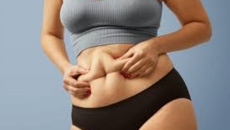 Important steps before and after liposuction in Riyadh