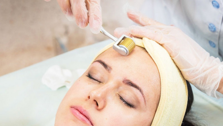 Microneedling Treatment in Delhi: Reverse Scars, Wrinkles, and Pigmentation