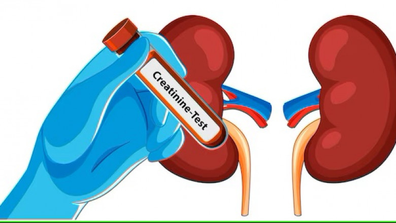 Ayurvedic Treatment for Kidney Creatinine: Natural Ways to Lower High Creatinine Levels
