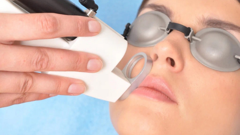 Say Goodbye to Scars with Fractional Laser